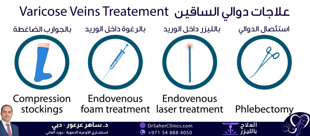 تقنيات علاج دوالي الساقين - أنواع العلاج للدوالي