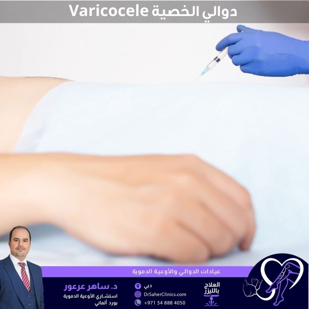 دوالي الخصية