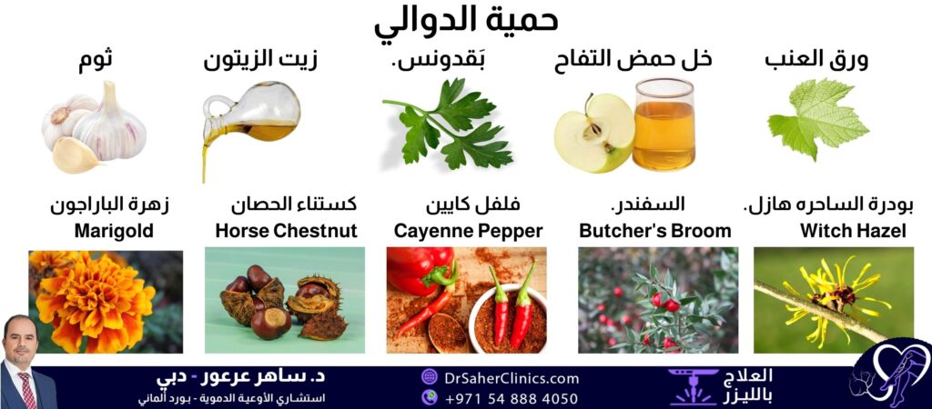 حمية دوالي الساقين، نظام غذائي يحمي بنسبة جيدة من الإصابة، ويخفف منها
