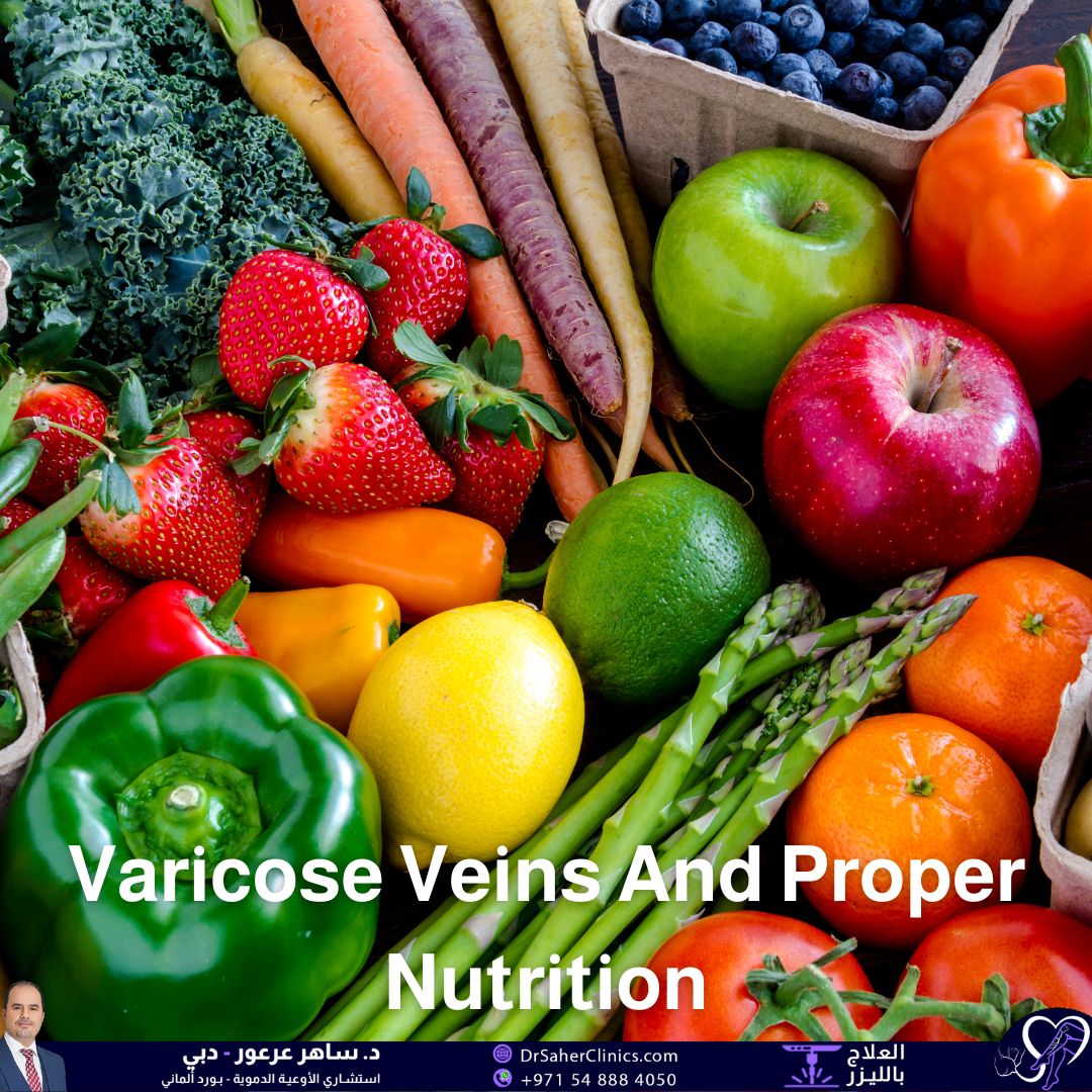 What is the Impact of Proper Nutrition to Avoid Varicose Veins, What are the Most Beneficial Foods, and Who are the Leading Specialists?