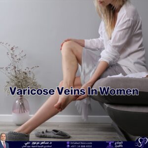 What are the causes of varicose veins in women, what are the treatment options, and what are the best clinics specialized in treating them