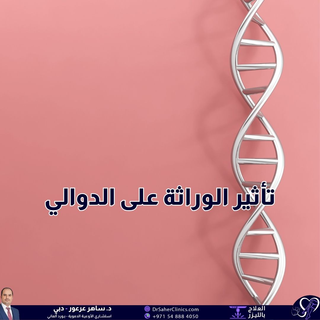  ما هو تأثير الوراثة على الدوالي؟ وما هي العوامل الوراثية المرتبطة بالدوالي؟ وما هي أفضل العيادات المختصة في علاج الدوالي؟